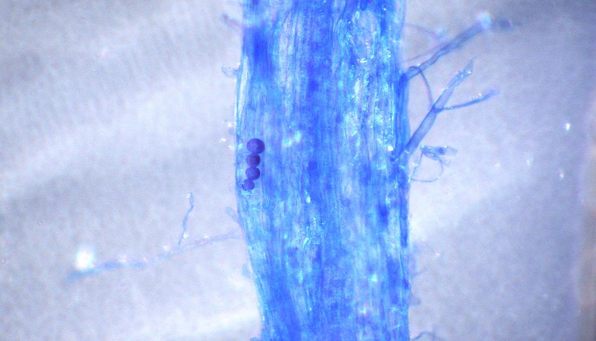Spore di Serendipita indica dentro la radice_micrscopio a luce