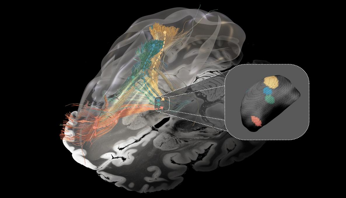 Foto sullo studio della nuova mappa della connessioni cerebrali per curare malattie degenerative